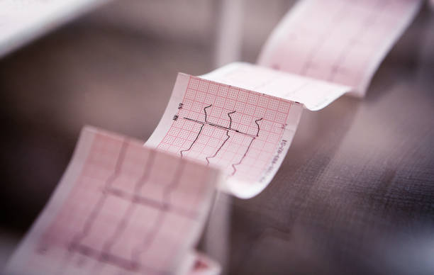 Frecuencia cardiaca